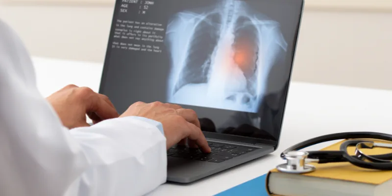 ¿Qué especialista trata la aspergilosis pulmonar?