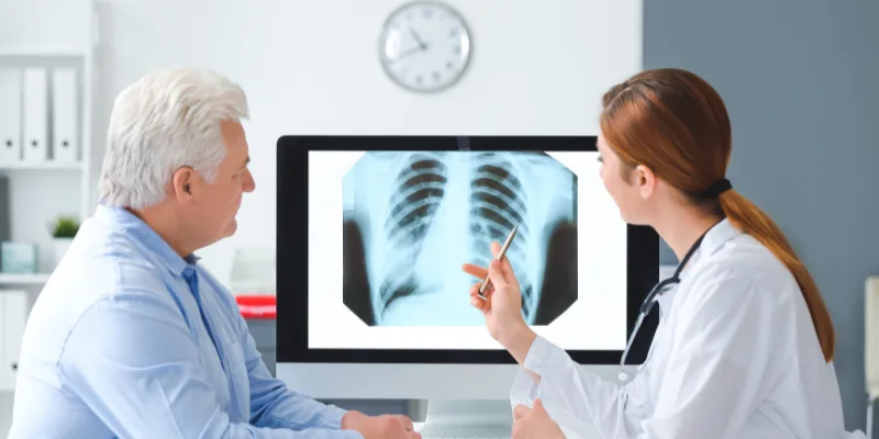 ¿Qué especialista trata el derrame pleural?